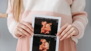 The Fabric of Fashion: Elevating Everyday Style with Jersey and Sweater Knit Dresses